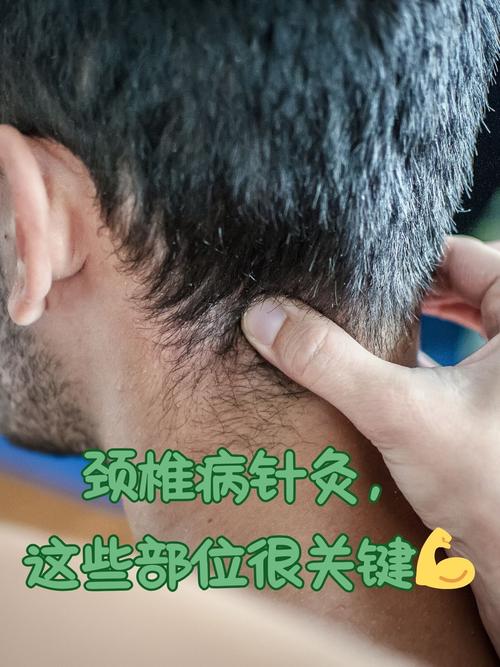 针灸可以治好颈椎病吗