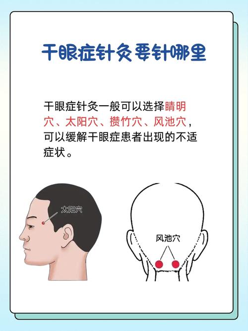 针灸治对眼睛有好处吗