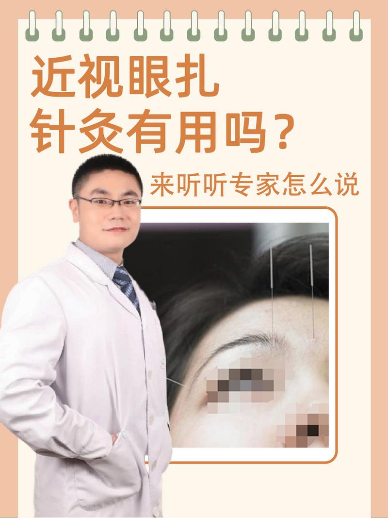 针灸治对眼睛有好处吗