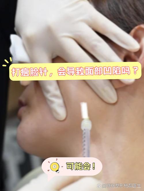 botox瘦脸针安全嘛