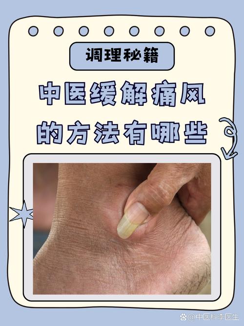 中医治疗痛风有效果吗