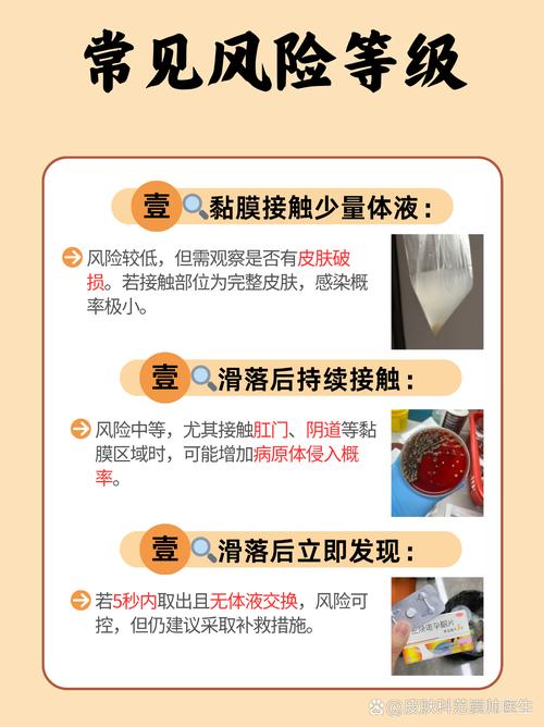 带安全套能预防性疾病吗