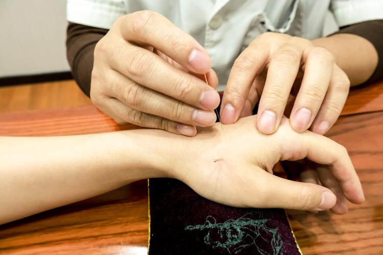 呼市哪有针灸好的中医