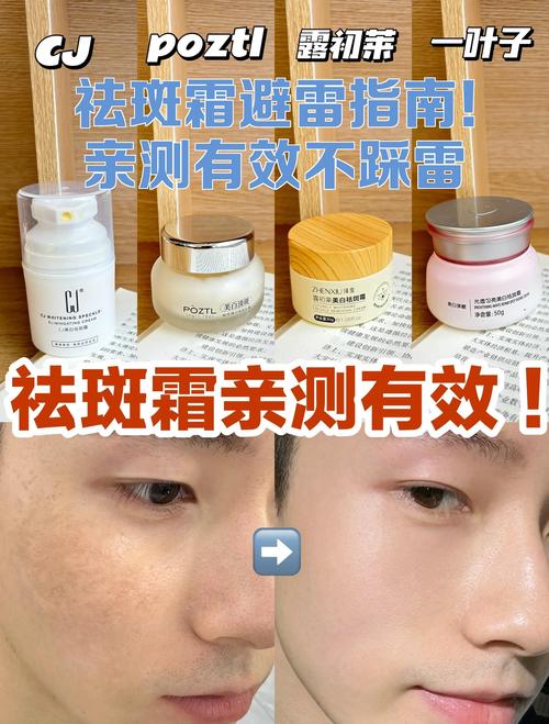 24磁光净肤去斑安全吗