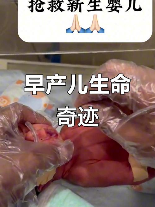 33周双胞胎算安全了吗