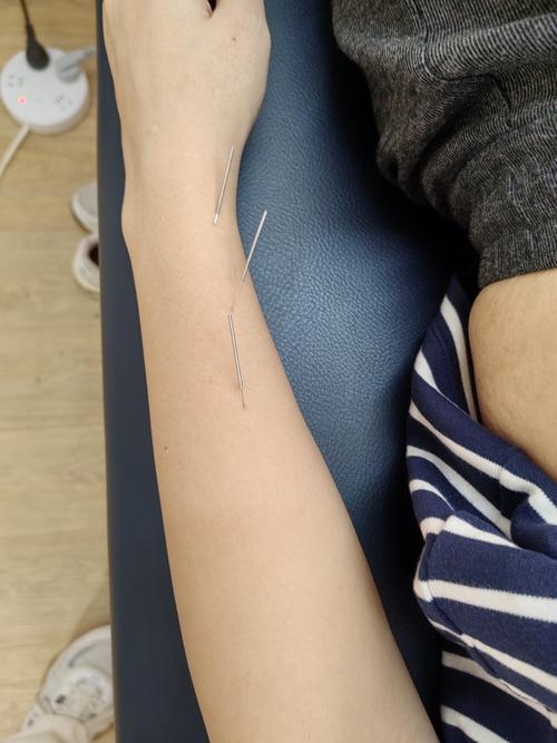 焦作好的针灸或者中医