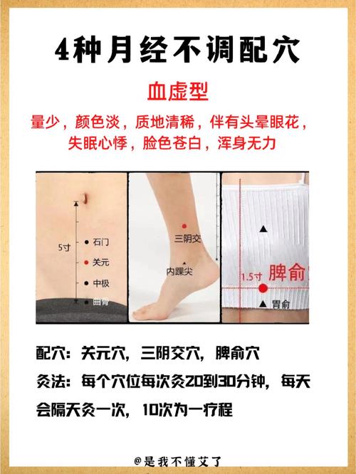月经量少针灸哪些穴位