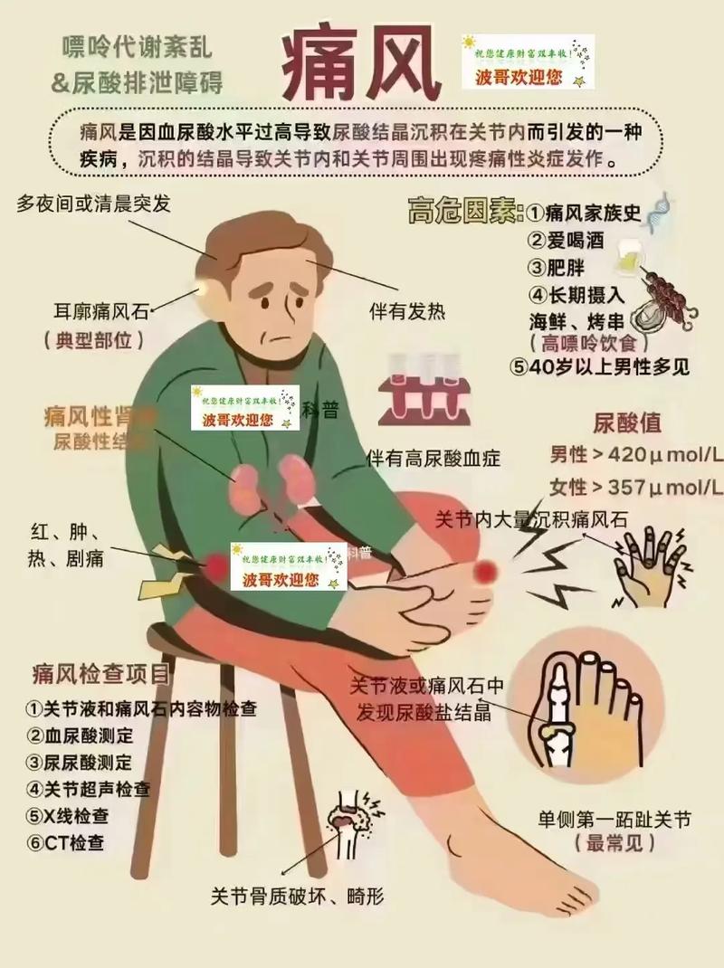 痛风的定义及临床表现