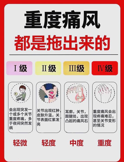 痛风的定义及临床表现