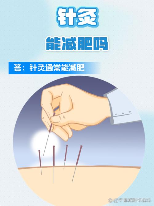 青少年可以针灸减肥吗