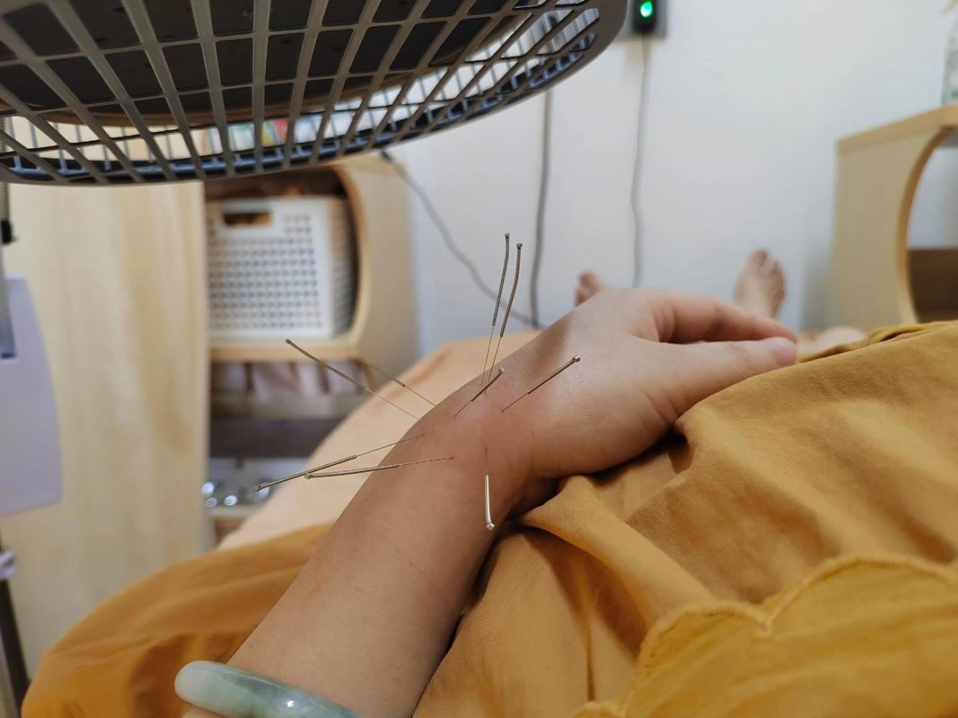 颈椎针灸后可以喝酒吗