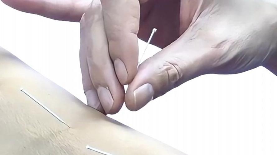 针灸能治疗乳腺结节吗