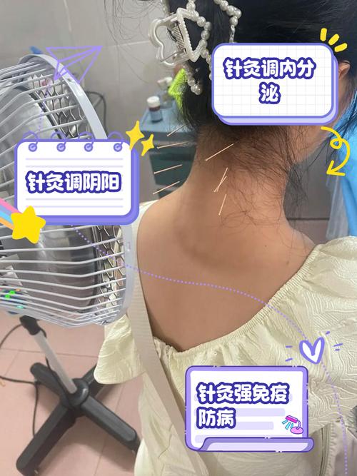 平衡针灸的好处与坏处