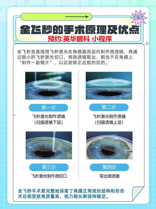 飞秒激光近视手术安全吗