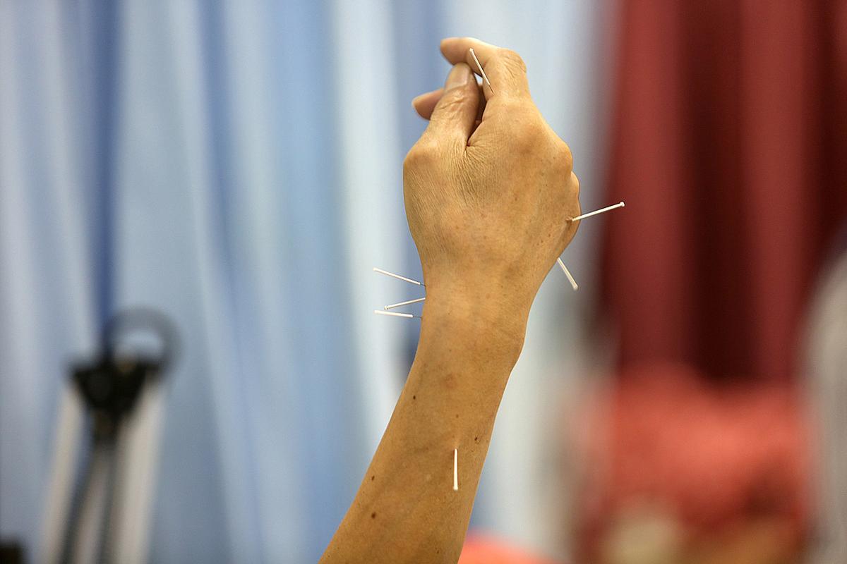 风湿针灸做多久有效果