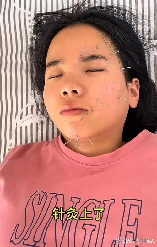 面瘫针灸好了后嘴角跳