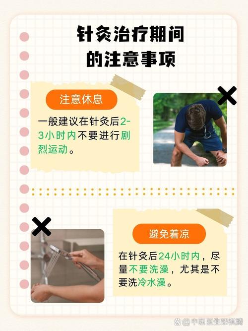 中医内科可以搞针灸吗