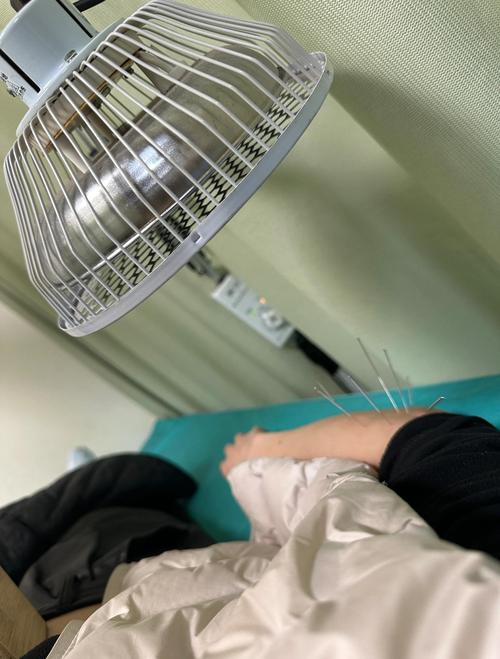 沈阳燕都哮喘针灸注射