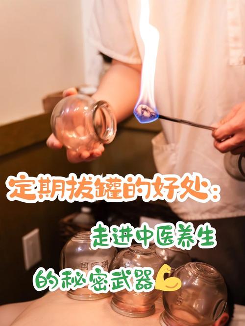 针灸拔火罐可以天天吗