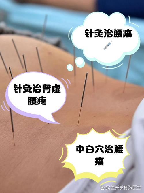 针灸能缓解腰椎劳损吗