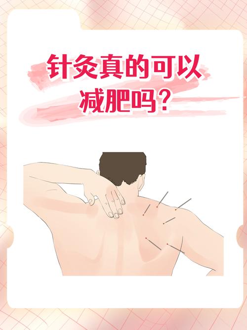 针灸减肥可以吃豆腐吗