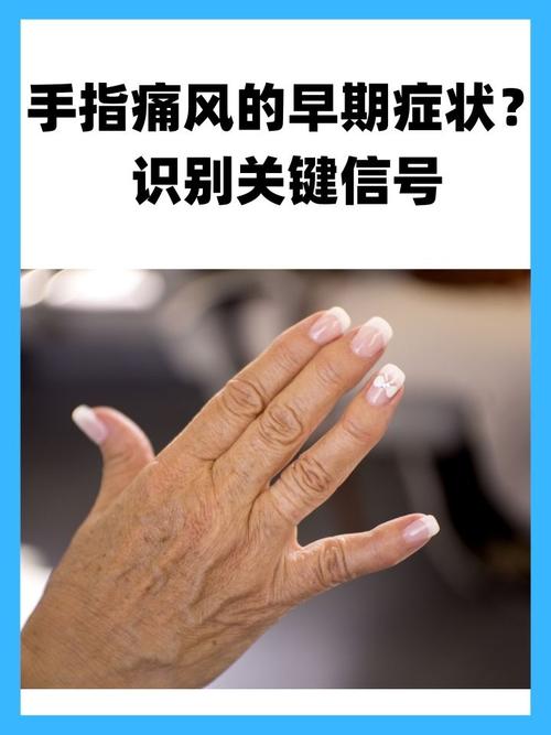 风湿痛风的症状有哪些