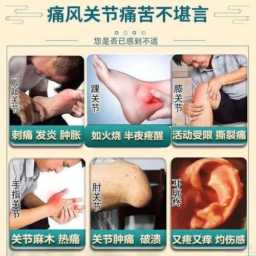 足疗对痛风治疗有效吗