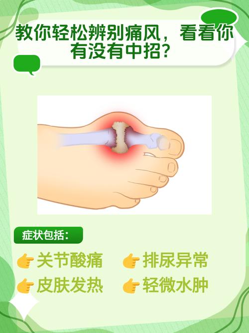 怎么样判断是不是痛风