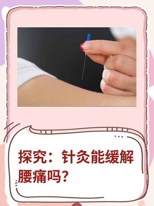 针灸治腰痛多少天有效