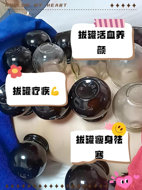 针灸拔火罐可以减肥吗