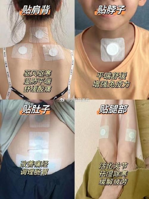 贴针灸退烧贴哪些部位