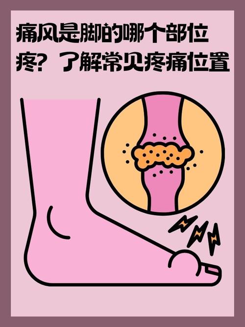 痛风排酸期为什么疼痛