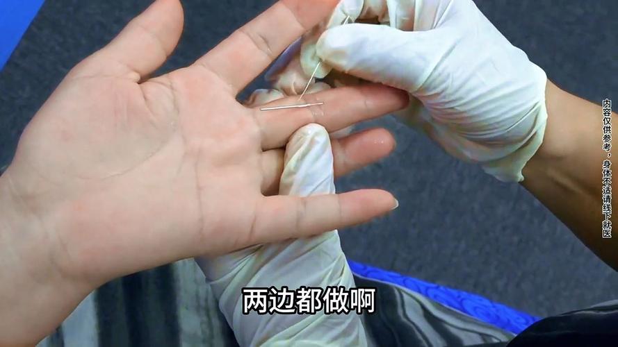 针灸可以治乳腺结节吗