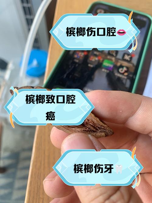 吃槟榔对痛风有影响吗