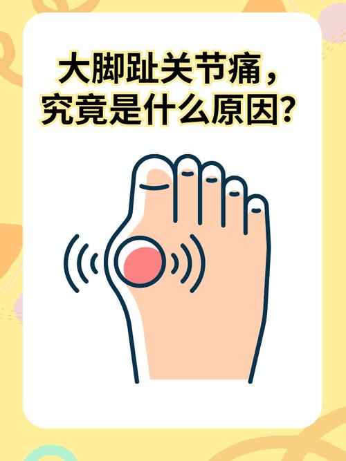 大脚趾疼是痛风初期吗