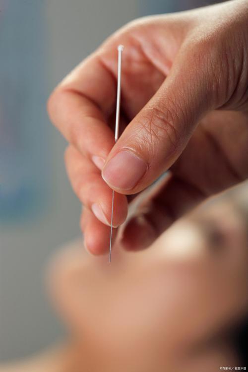 针灸哪个部位容易流产
