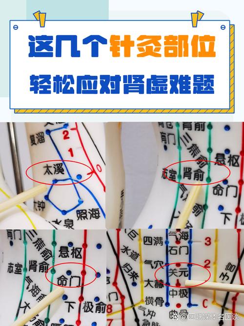 针灸哪个部位容易流产