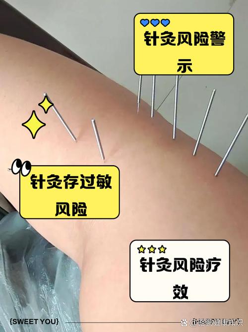 盆腔积液针灸效果好吗