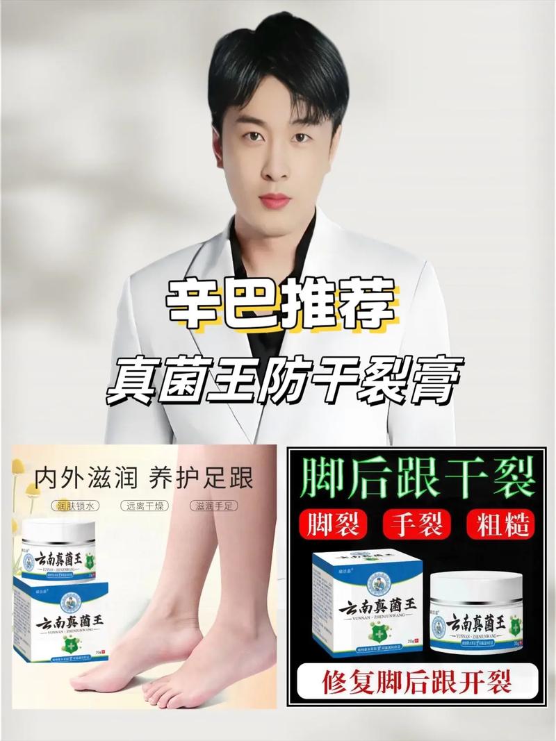 脚后跟疼痛风吃什么药