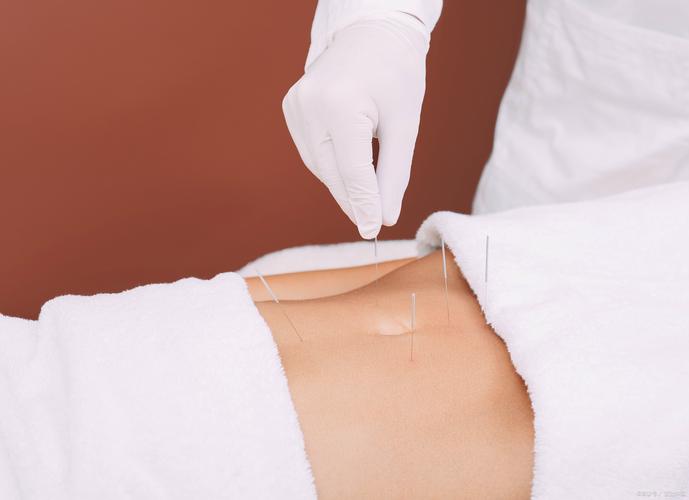 武汉同济医院针灸减肥