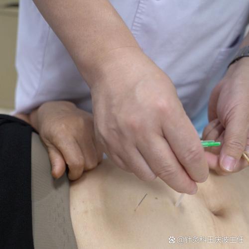 武汉同济医院针灸减肥