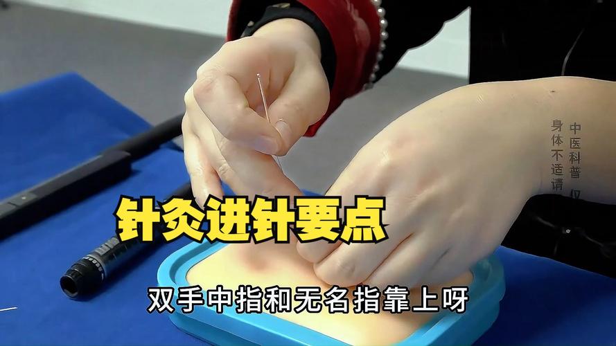 民间针灸绝活视频教学