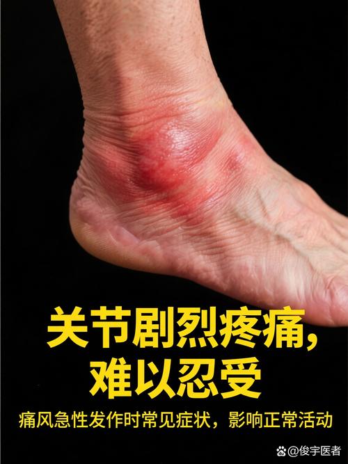 痛风好后总感觉不舒服