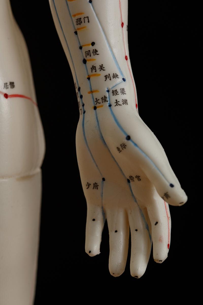 手腕扭伤针灸什么学位