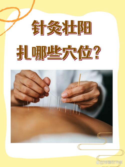 针灸治疗肾虚扎针哪里