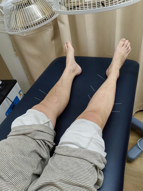 成都哪里可以学习针灸