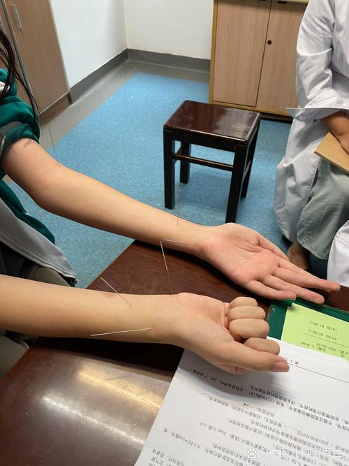 齐齐哈尔哪里针灸小孩