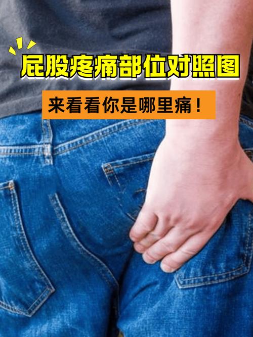 痛风会引起臀部疼痛吗