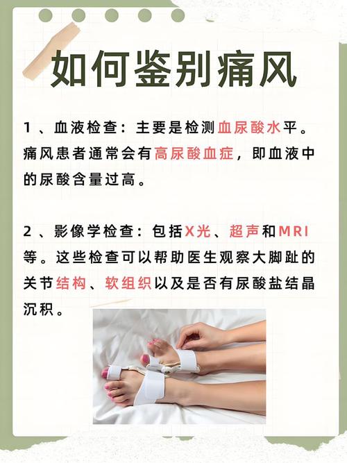 痛风的病程有几个分期