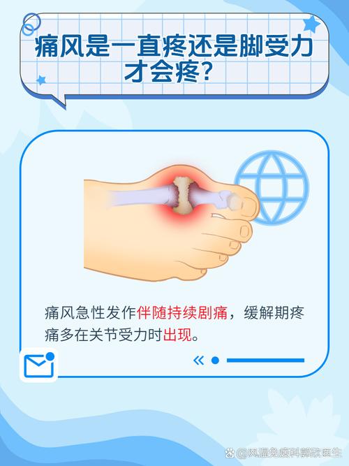 痛风初期是轻微疼痛吗